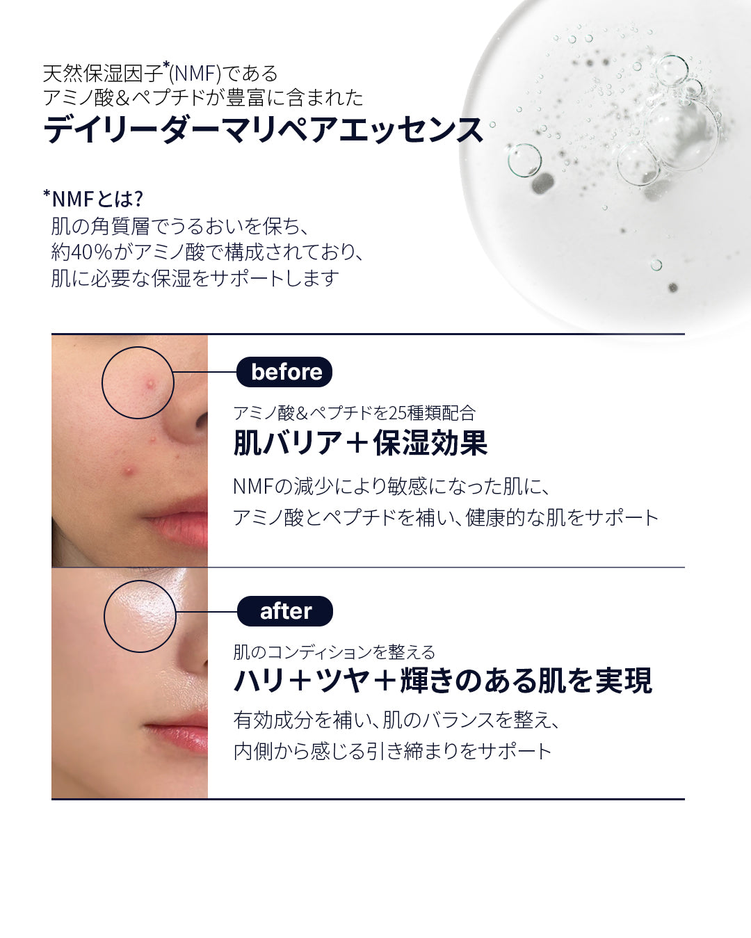 [K BOOSTER]デイリーダーマリペアエッセンス  50ml